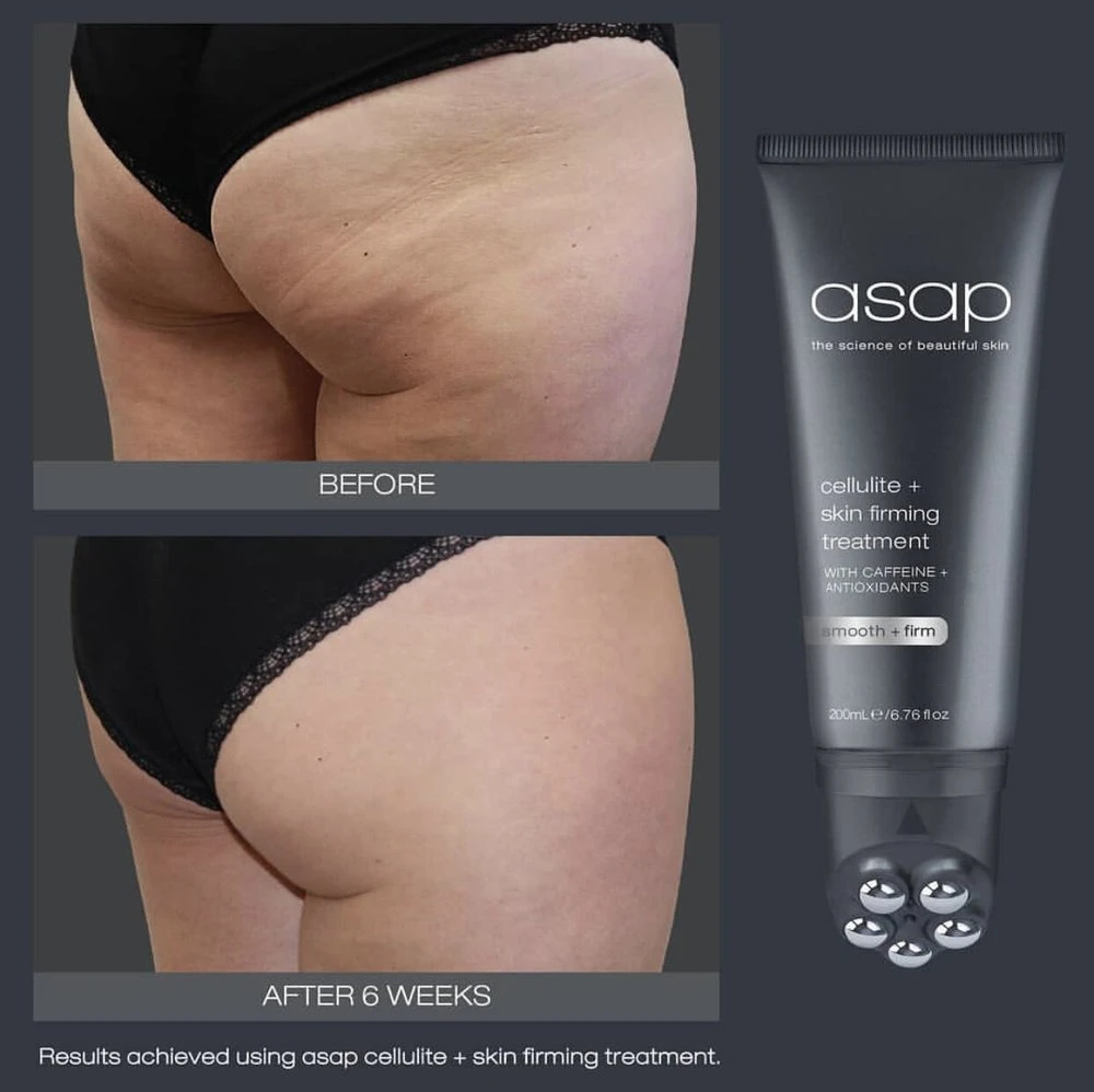 Asap Cellulite And Skin Firming Treatment - Image 5